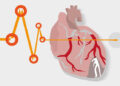 Sudden Cardiac Arrests: Unraveling the Science Behind the Headlines -July 17, 2025