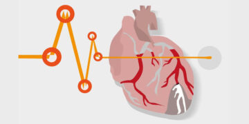Sudden Cardiac Arrests: Unraveling the Science Behind the Headlines -July 17, 2025