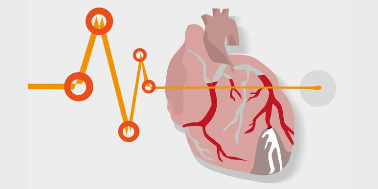 Sudden Cardiac Arrests: Unraveling the Science Behind the Headlines -July 17, 2025