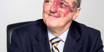 Spanish Scientist Reports Breakthrough That Eliminates Pancreatic Cancer in Lab Models